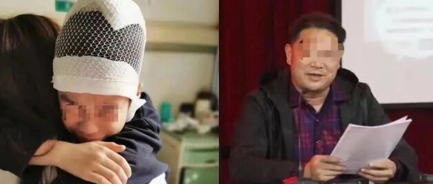 皮骨分离、7次穿刺!老师竟对学生下如此重手