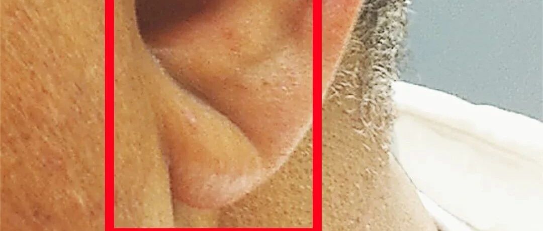 哪些症状是真正的猝死信号？