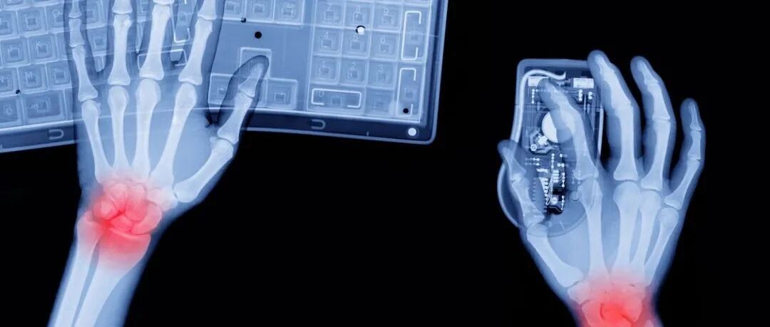 3步自测：你的手是不是“病”了？