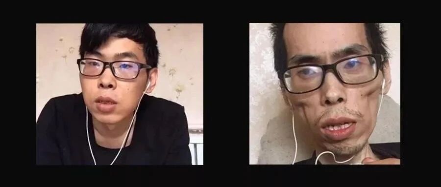 34岁网红去世，一年时间急速衰老，一张图刺痛全网……