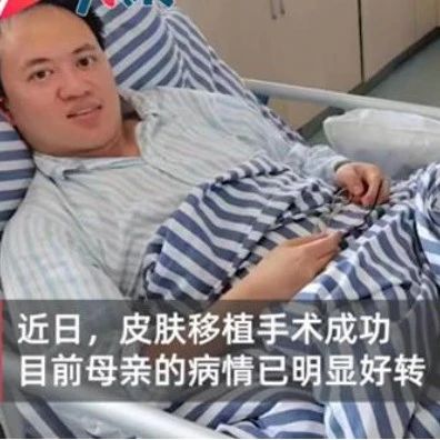 【8点见】母亲意外烧伤，儿子割大腿三分之二皮肤救母