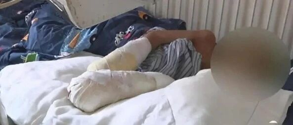 【8点见】7岁男童被亲生父亲虐待，双手面临截肢