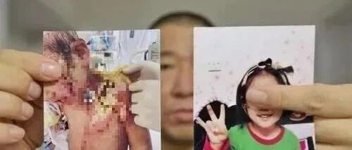 亲妈？下得了手？？？