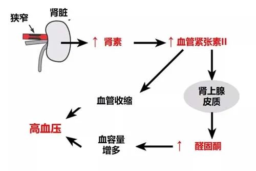 带你看报告｜血浆肾素测定，您了解吗？