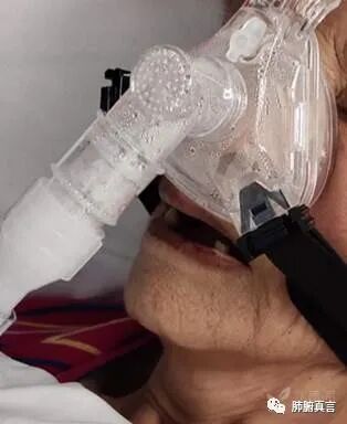 呼吸机f指什么呼吸机名词解释（三）_https://www.jmylbn.com_新闻资讯_第31张