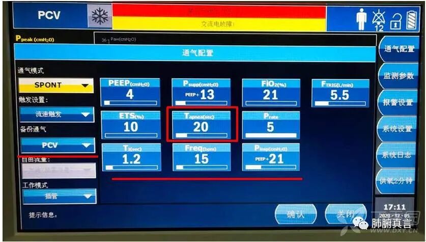 呼吸机f指什么呼吸机名词解释（三）_https://www.jmylbn.com_新闻资讯_第42张