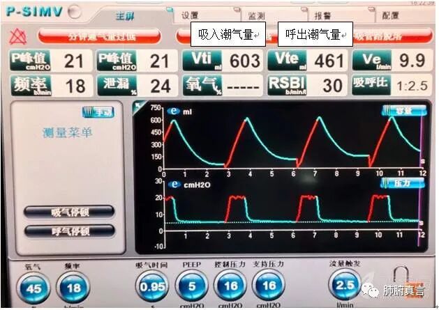 呼吸机f指什么呼吸机名词解释（三）_https://www.jmylbn.com_新闻资讯_第38张