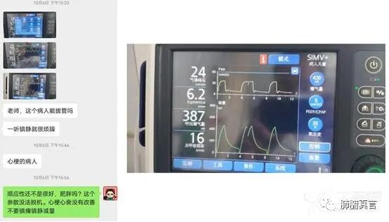 呼吸机f指什么呼吸机名词解释（三）_https://www.jmylbn.com_新闻资讯_第34张