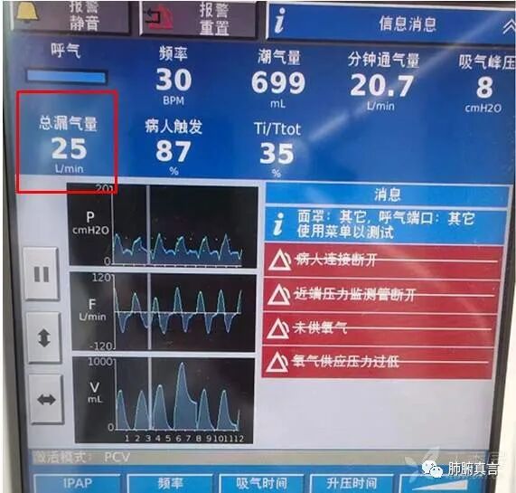 呼吸机f指什么呼吸机名词解释（三）_https://www.jmylbn.com_新闻资讯_第44张