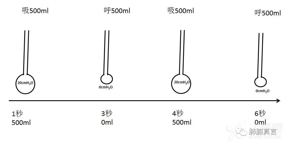 呼吸机f指什么呼吸机名词解释（三）_https://www.jmylbn.com_新闻资讯_第13张