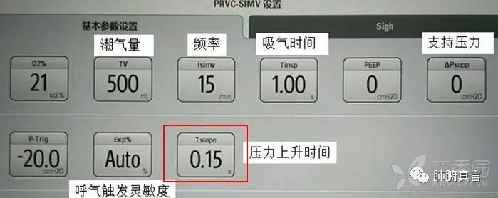 呼吸机f指什么呼吸机名词解释（三）_https://www.jmylbn.com_新闻资讯_第21张