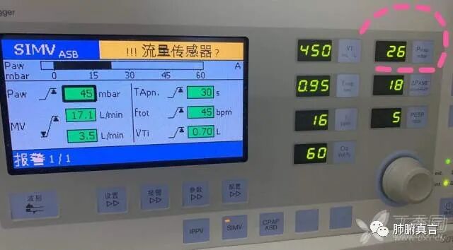 呼吸机f指什么呼吸机名词解释（三）_https://www.jmylbn.com_新闻资讯_第12张