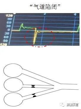呼吸机f指什么呼吸机名词解释（三）_https://www.jmylbn.com_新闻资讯_第17张