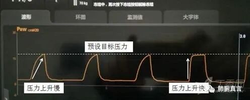 呼吸机f指什么呼吸机名词解释（三）_https://www.jmylbn.com_新闻资讯_第22张