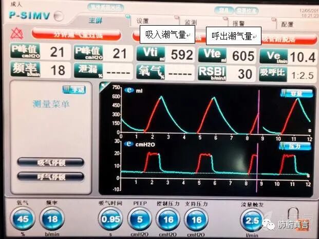 呼吸机f指什么呼吸机名词解释（三）_https://www.jmylbn.com_新闻资讯_第37张