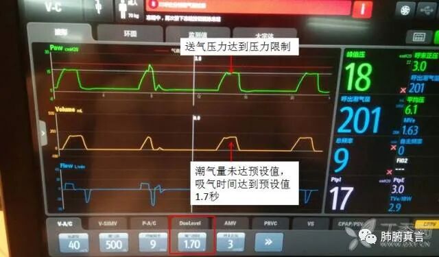 呼吸机f指什么呼吸机名词解释（三）_https://www.jmylbn.com_新闻资讯_第10张