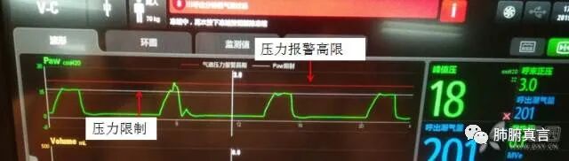 呼吸机f指什么呼吸机名词解释（三）_https://www.jmylbn.com_新闻资讯_第9张