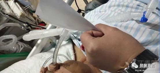 呼吸机f指什么呼吸机名词解释（三）_https://www.jmylbn.com_新闻资讯_第36张