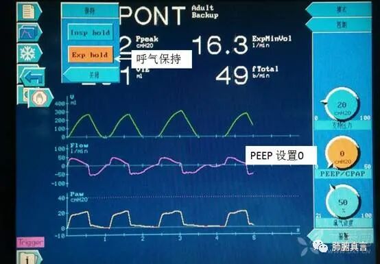 呼吸机f指什么呼吸机名词解释（三）_https://www.jmylbn.com_新闻资讯_第23张