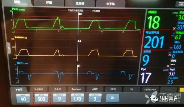 呼吸机f指什么呼吸机名词解释（三）_https://www.jmylbn.com_新闻资讯_第8张