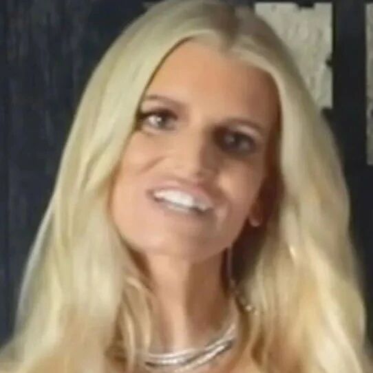 Jessica Simpson 瞬间衰老,撞脸 Donatella,粉丝担心健康状况.