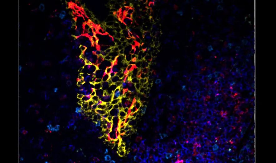 Aivia 14發(fā)布會(huì)：開啟3D空間生物學(xué)分析新紀(jì)元