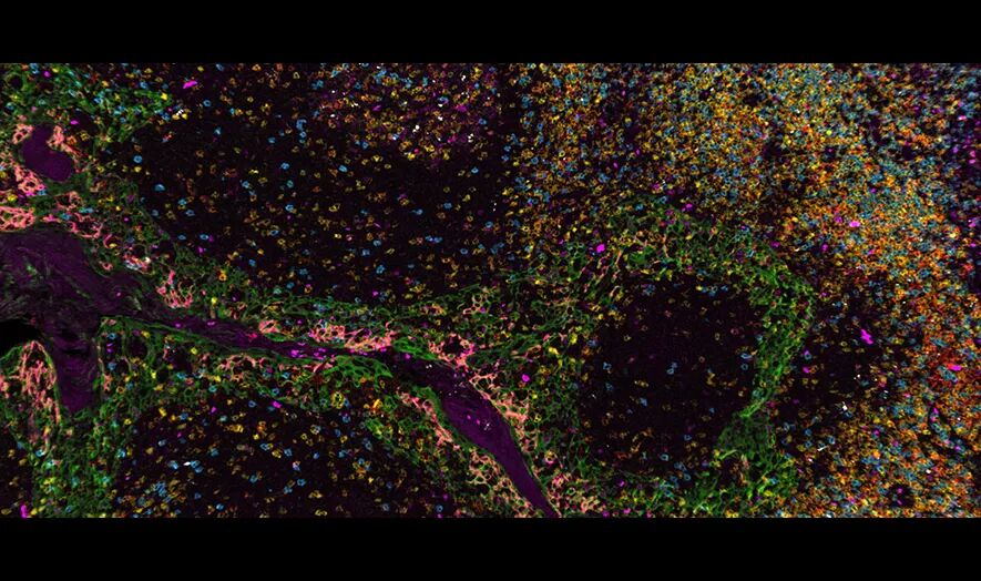 Aivia 14發(fā)布會(huì)：開啟3D空間生物學(xué)分析新紀(jì)元