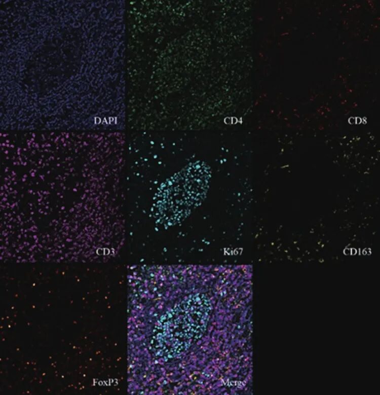 徠卡精準(zhǔn)空間生物學(xué)解決方案 第三彈