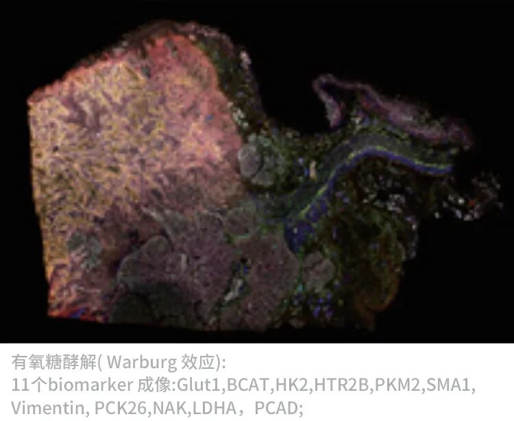 徠卡精準(zhǔn)空間生物學(xué)解決方案 第四彈