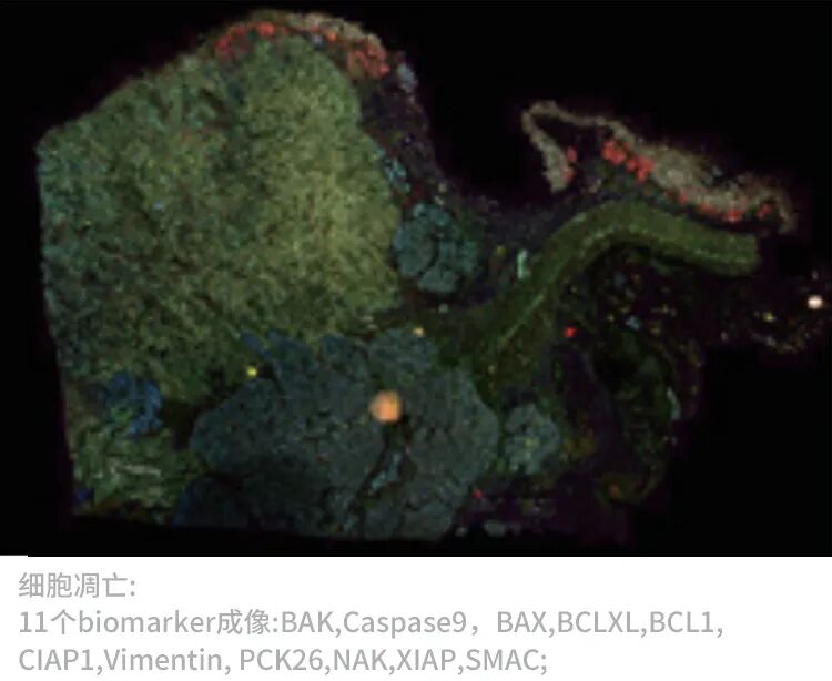 徠卡精準(zhǔn)空間生物學(xué)解決方案 第四彈
