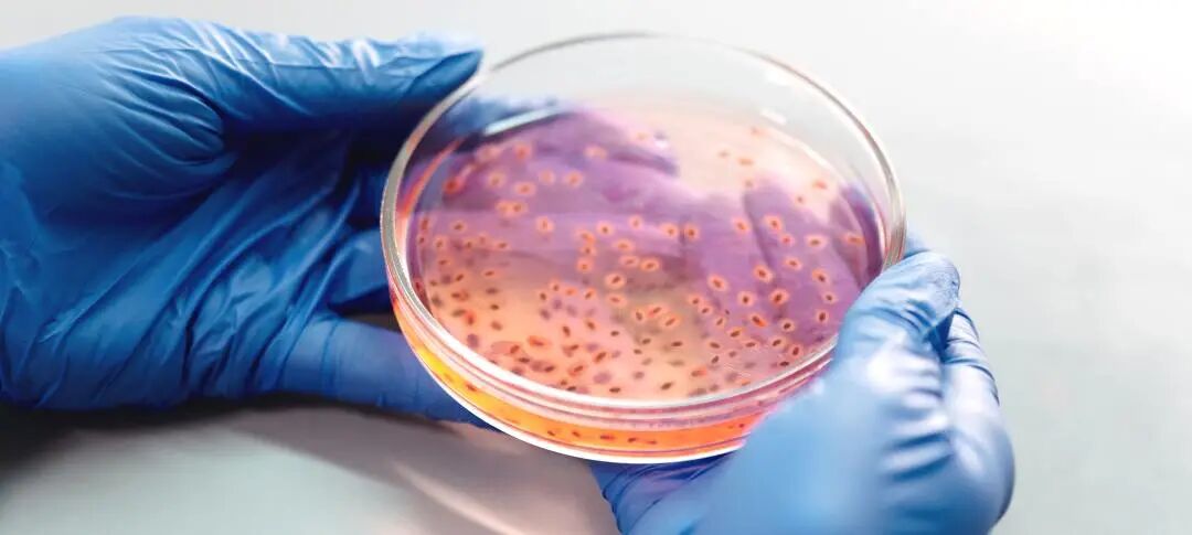 微生物实验室常见错误操作你中了几条