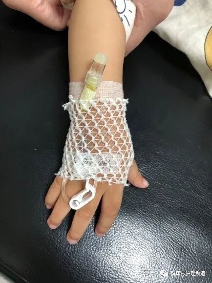 留置针绷带怎么缠小儿静脉留置针的7个固定小妙招，儿科护士都学起来！_https://www.jmylbn.com_新闻资讯_第5张