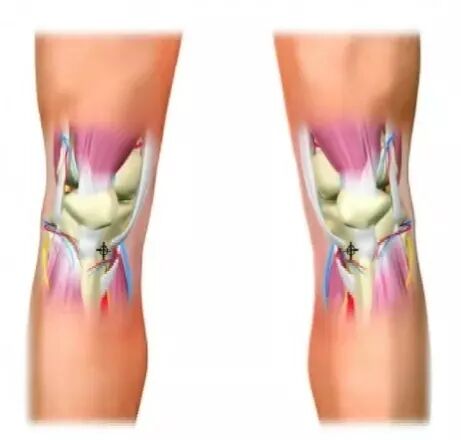 穿刺枪怎么升级淄博市中心医院急救科成功“打响”骨髓腔穿刺第一枪_https://www.jmylbn.com_新闻资讯_第5张