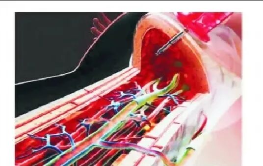 穿刺枪怎么升级淄博市中心医院急救科成功“打响”骨髓腔穿刺第一枪_https://www.jmylbn.com_新闻资讯_第4张