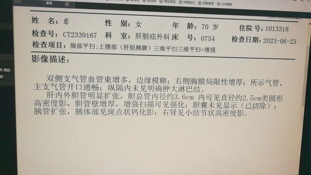 开刀孔怎么开刀既往20年3次开刀手术，盲人患者饱受肝胆结石之苦，再次手术几个微创钥匙孔解决大问题_https://www.jmylbn.com_新闻资讯_第8张