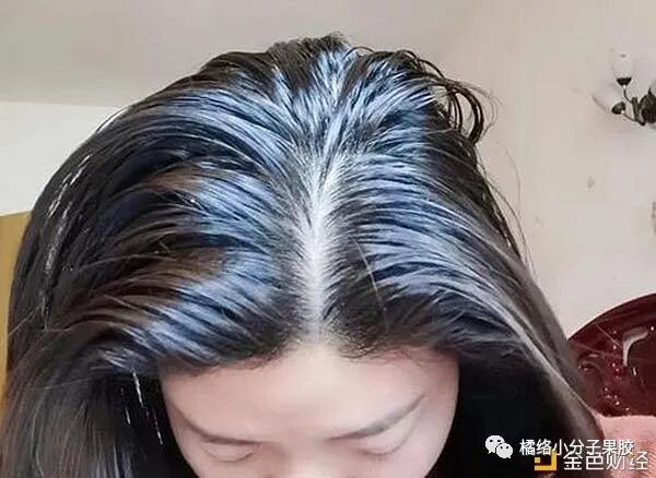 头发爱出油，脱发，都有可能是体内湿气过重