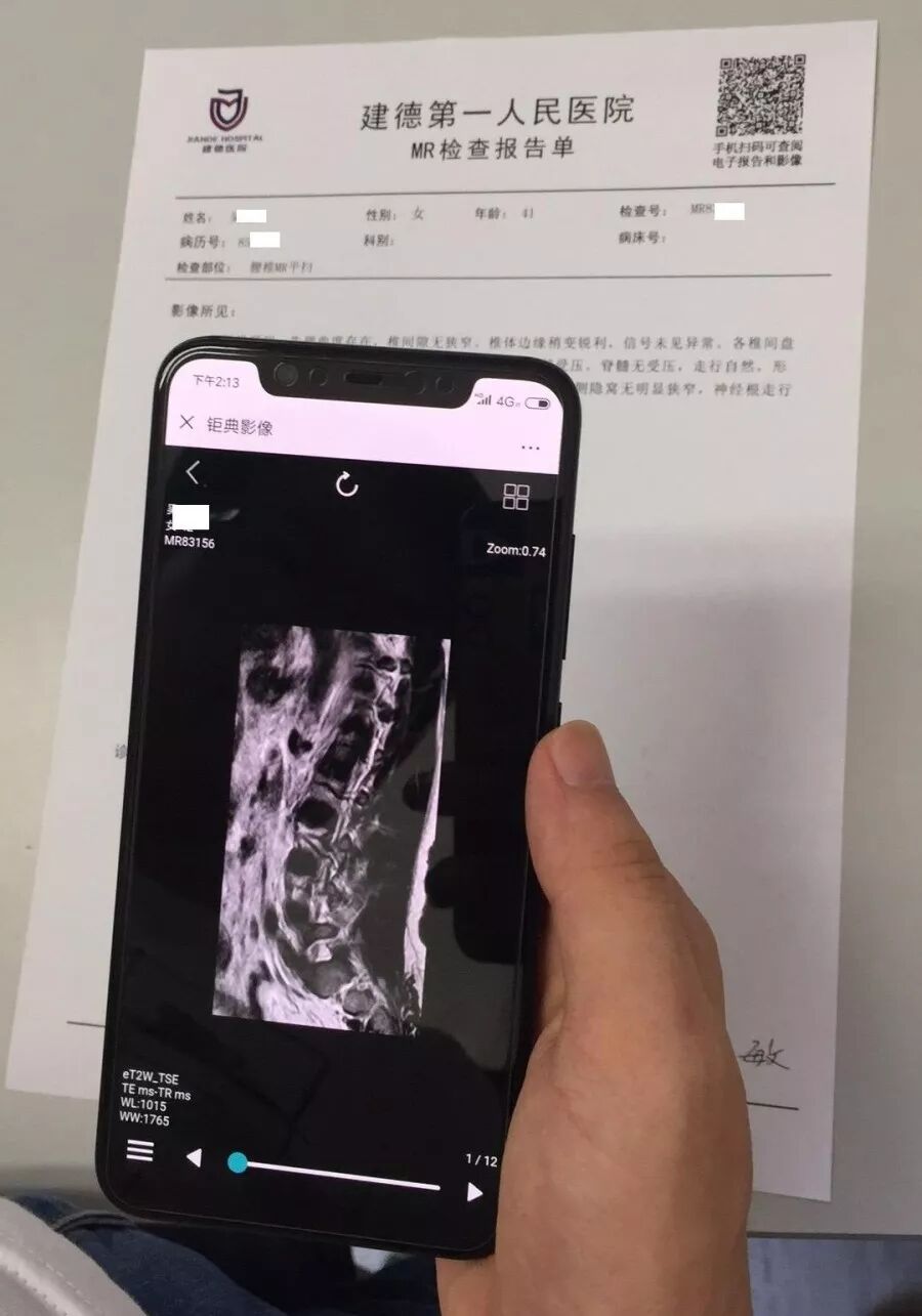 x光和dr有什么区别X、DR、CT、MRI……都是拍片，区别其实很简单_https://www.jmylbn.com_新闻资讯_第15张