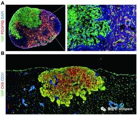 Science：揭示癌細胞在淋巴結中適應和茁壯生長機制 健康 第2張