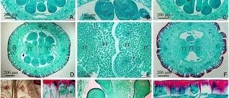Nature：简单的DNA扭曲决定了胎盘的命运