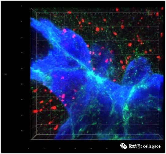 Nature：揭示乳癌向大腦轉移新機制 健康 第2張