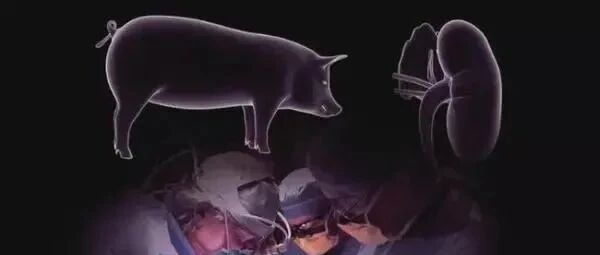 太激动了！世界首例：猪肾已被移植到人体内，暂时未发生排异反应
