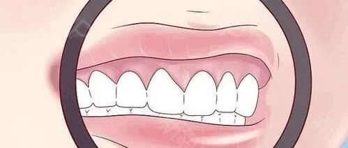 Cell：出乎意料！口腔微生物隐藏着肠道疾病的治疗方法！