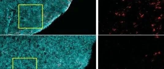 Cell重磅解读！肥胖损伤免疫细胞功能并加速肿瘤生长的分子机制！