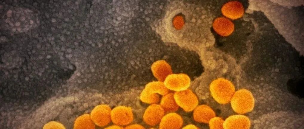 Nature子刊：康复后仍免疫缺陷，新冠病毒对B细胞到底还做了什么？！