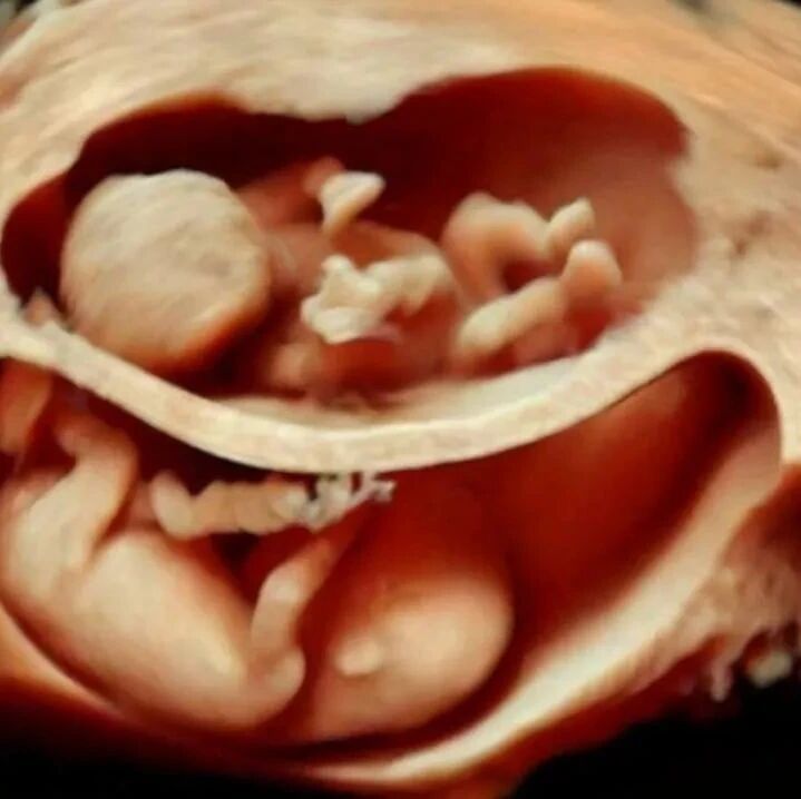 “性别之战”始于子宫：父亲和母亲的基因在营养问题上就开始了拉锯战！