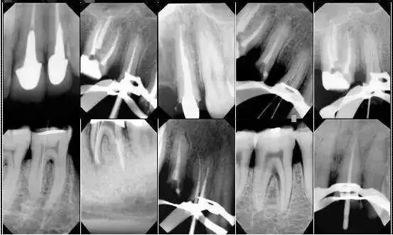 为什么牙医不用开口器为什么牙医不选择在微信（网上）看牙？是因为牙医高冷吗？_https://www.jmylbn.com_新闻资讯_第13张