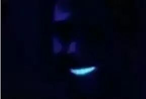 为什么牙医不用开口器刷屏朋友圈的冷光美牙仪，背后隐藏的风险你了解吗？_https://www.jmylbn.com_新闻资讯_第8张