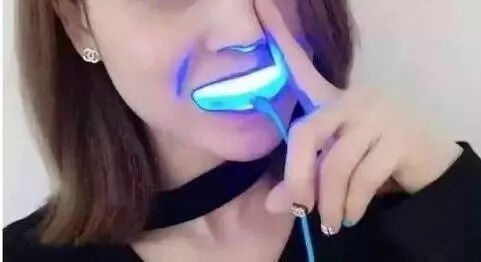 为什么牙医不用开口器刷屏朋友圈的冷光美牙仪，背后隐藏的风险你了解吗？_https://www.jmylbn.com_新闻资讯_第9张