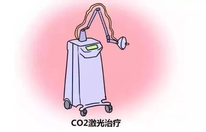 什么是妇科激光光的“黑科技”——CO₂激光治疗技术为妇科疾病患者解除痛苦_https://www.jmylbn.com_新闻资讯_第8张