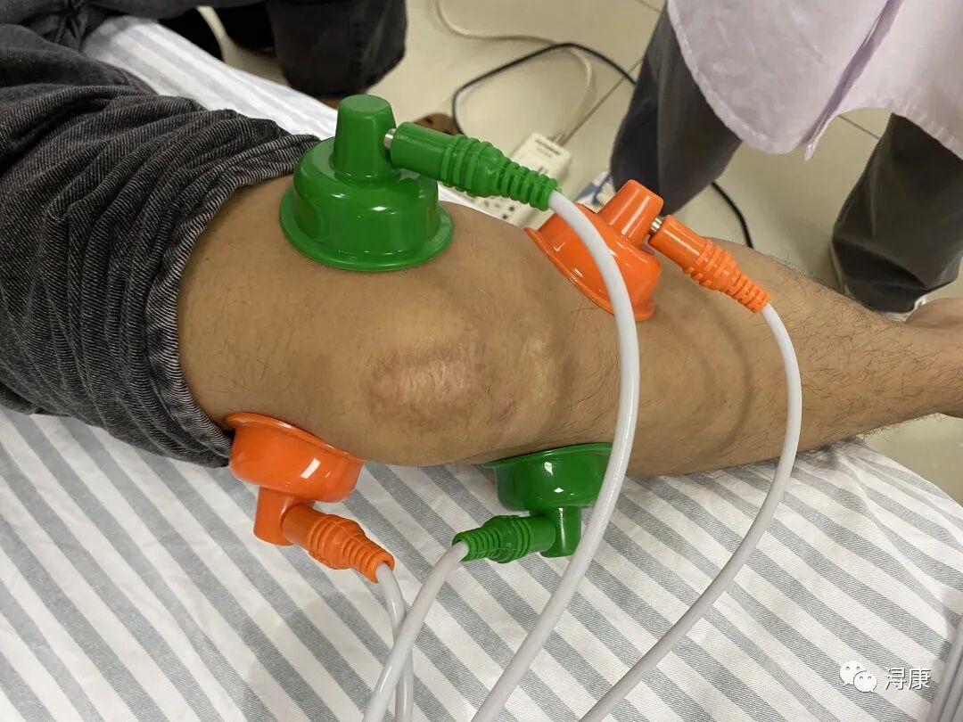 中频为什么能镇痛疼痛克星，解痉神器——中频干扰电_https://www.jmylbn.com_新闻资讯_第8张